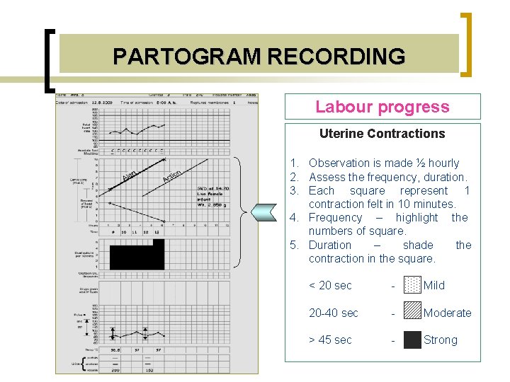 PARTOGRAM RECORDING Labour progress Uterine Contractions 1. Observation is made ½ hourly 2. Assess