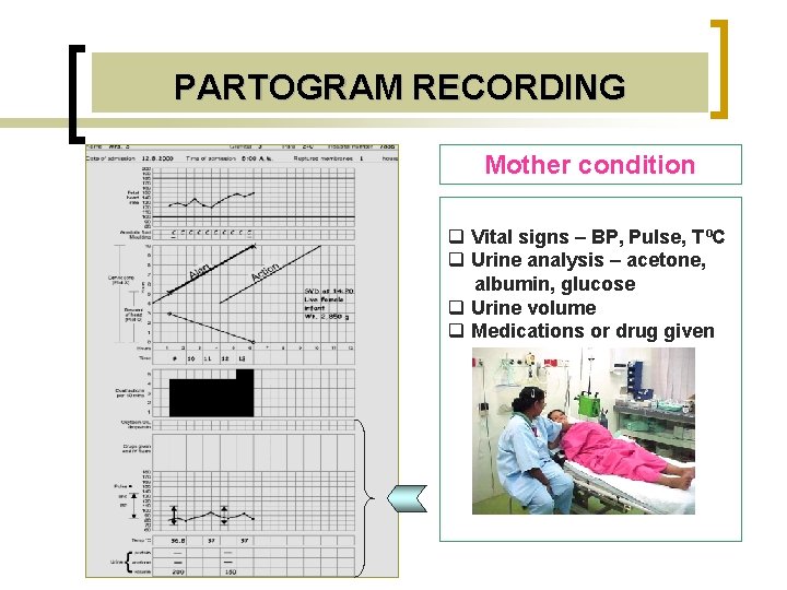 PARTOGRAM RECORDING Mother condition q Vital signs – BP, Pulse, TºC q Urine analysis