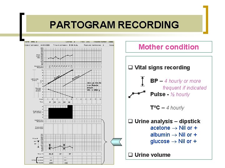 PARTOGRAM RECORDING Mother condition q Vital signs recording BP – 4 hourly or more