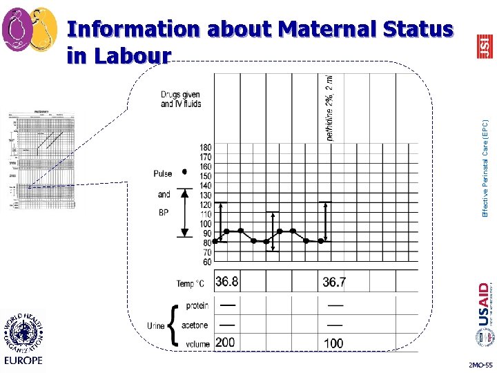 Effective Perinatal Care (EPC) Information about Maternal Status in Labour 2 MO-55 