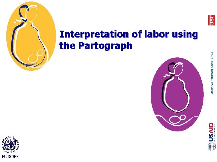 Effective Perinatal Care (EPC) Interpretation of labor using the Partograph 