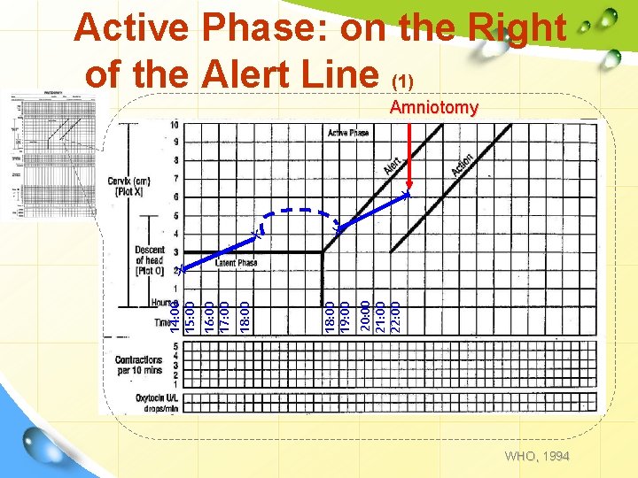 Active Phase: on the Right of the Alert Line (1) Amniotomy X X X