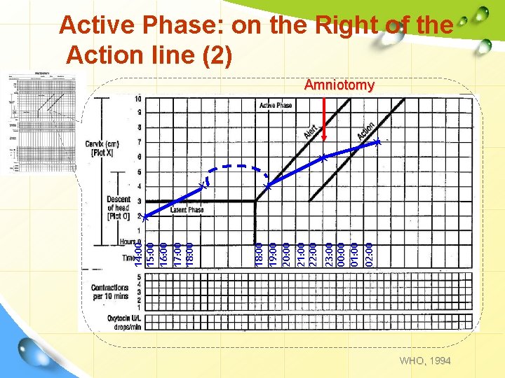 Active Phase: on the Right of the Action line (2) Amniotomy X X 18: