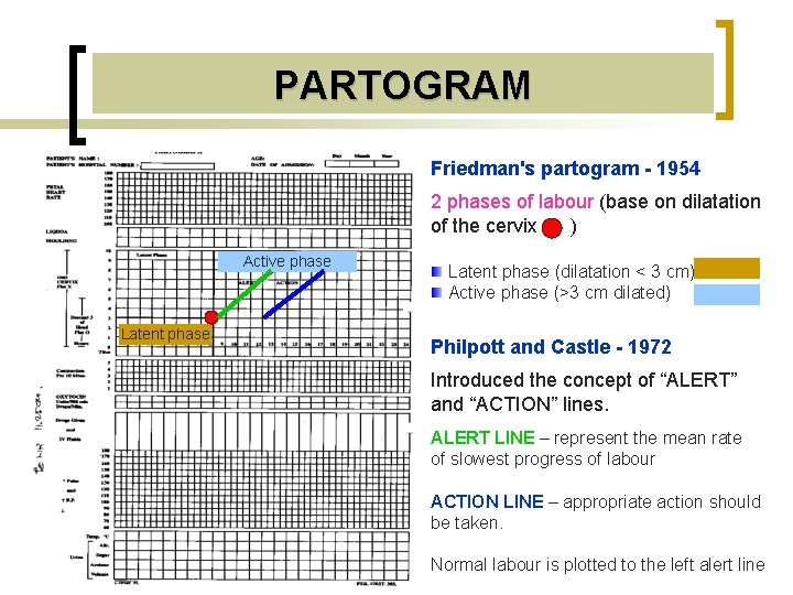 PARTOGRAM Friedman's partogram - 1954 2 phases of labour (base on dilatation of the