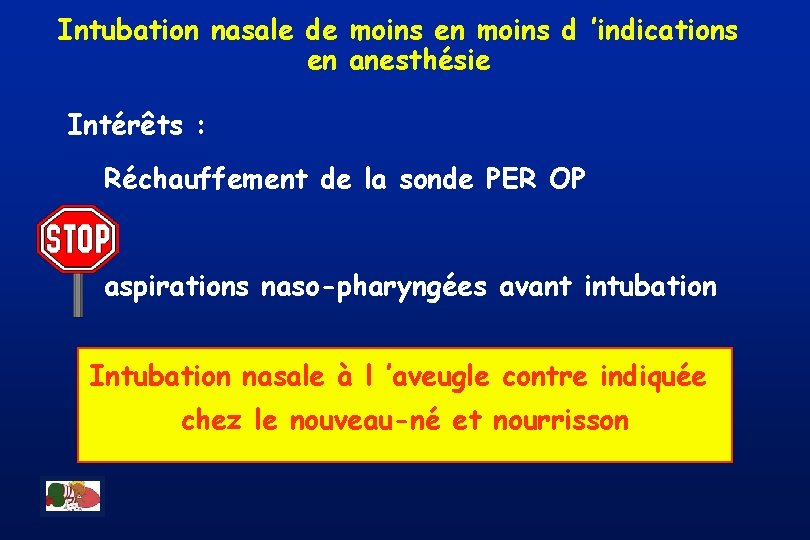 Intubation nasale de moins en moins d ’indications en anesthésie Intérêts : Réchauffement de