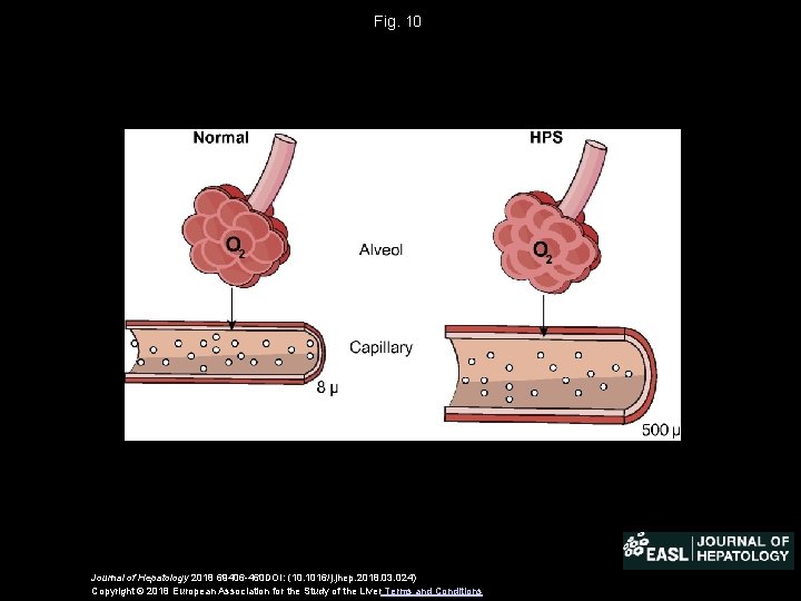 Fig. 10 Journal of Hepatology 2018 69406 -460 DOI: (10. 1016/j. jhep. 2018. 03.
