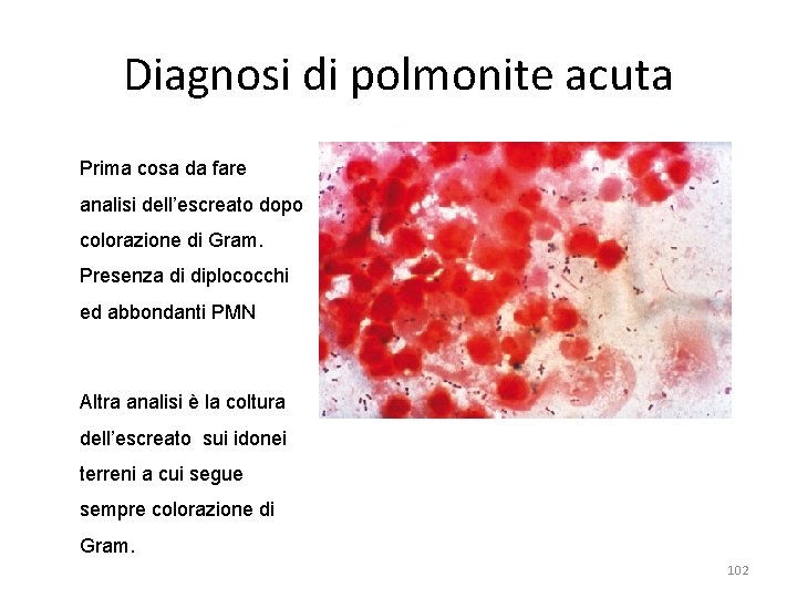 Diagnosi di polmonite acuta Prima cosa da fare analisi dell’escreato dopo colorazione di Gram.
