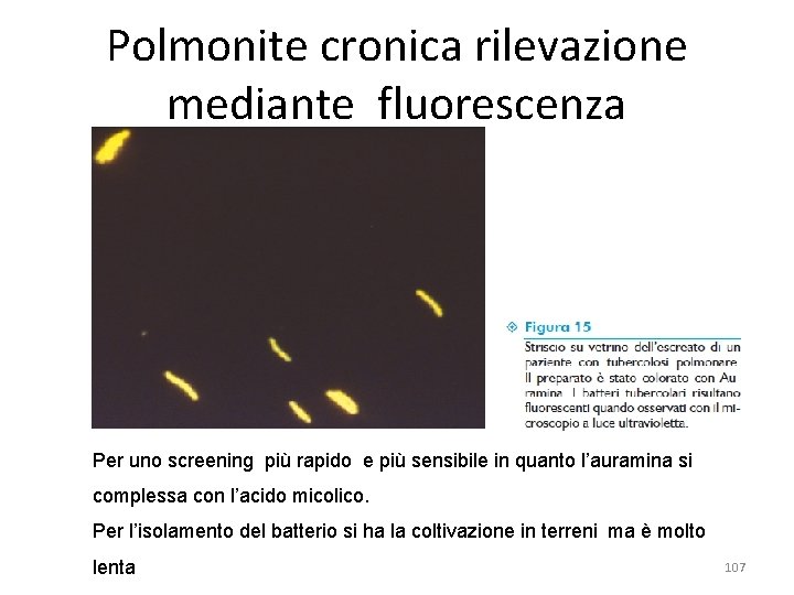 Polmonite cronica rilevazione mediante fluorescenza Per uno screening più rapido e più sensibile in