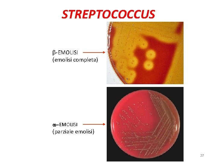 STREPTOCOCCUS b-EMOLISI (emolisi completa) a-EMOLISI (parziale emolisi) 27 