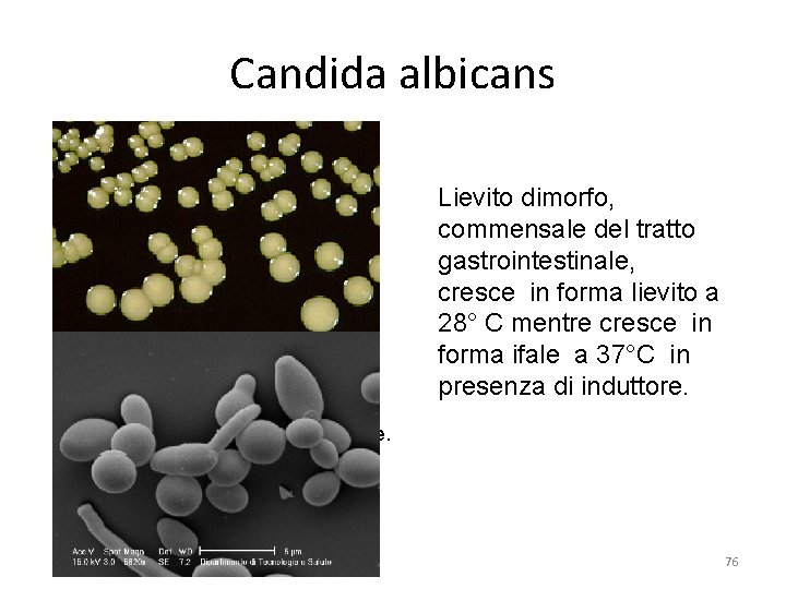 Candida albicans Lievito dimorfo, commensale del tratto gastrointestinale, cresce in forma lievito a 28°