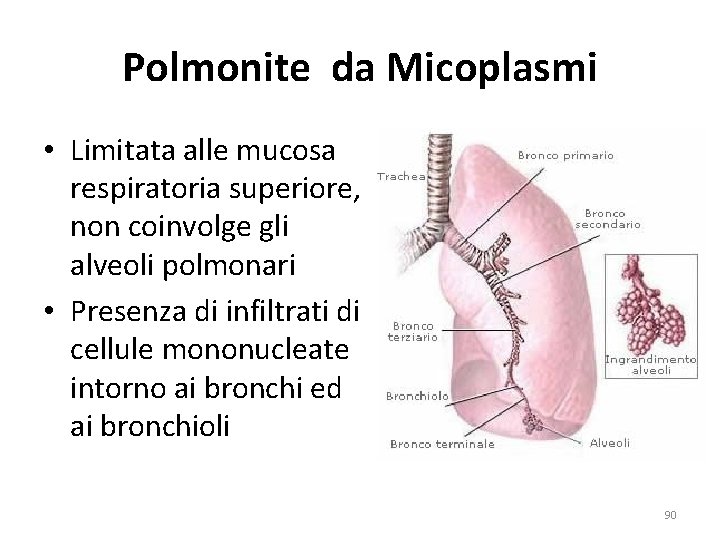 Polmonite da Micoplasmi • Limitata alle mucosa respiratoria superiore, non coinvolge gli alveoli polmonari