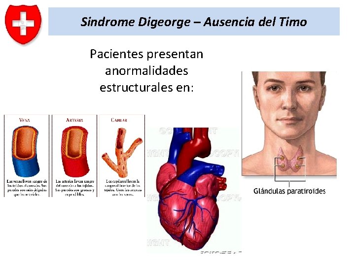 Sindrome Digeorge – Ausencia del Timo Pacientes presentan anormalidades estructurales en: 