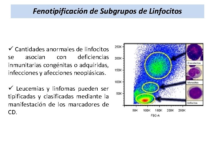 Fenotipificación de Subgrupos de Linfocitos ü Cantidades anormales de linfocitos se asocian con deficiencias