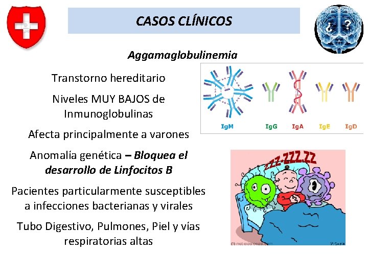 CASOS CLÍNICOS Aggamaglobulinemia Transtorno hereditario Niveles MUY BAJOS de Inmunoglobulinas Afecta principalmente a varones