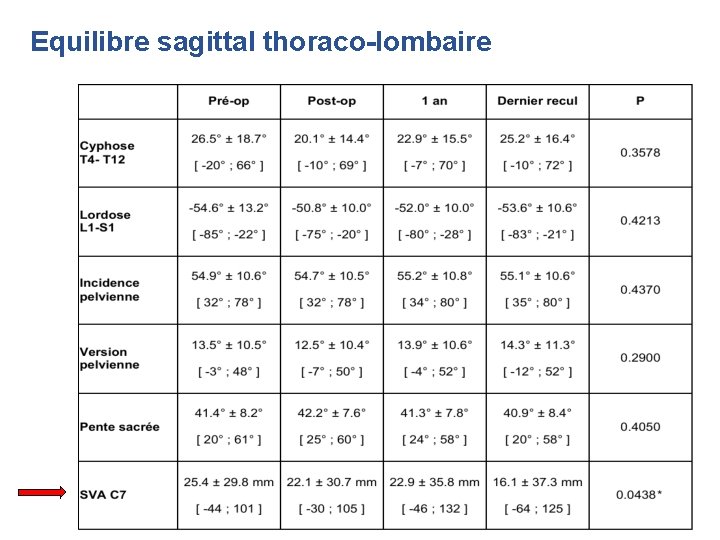 Equilibre sagittal thoraco-lombaire Equilibre sagittal thoraco-lombaire