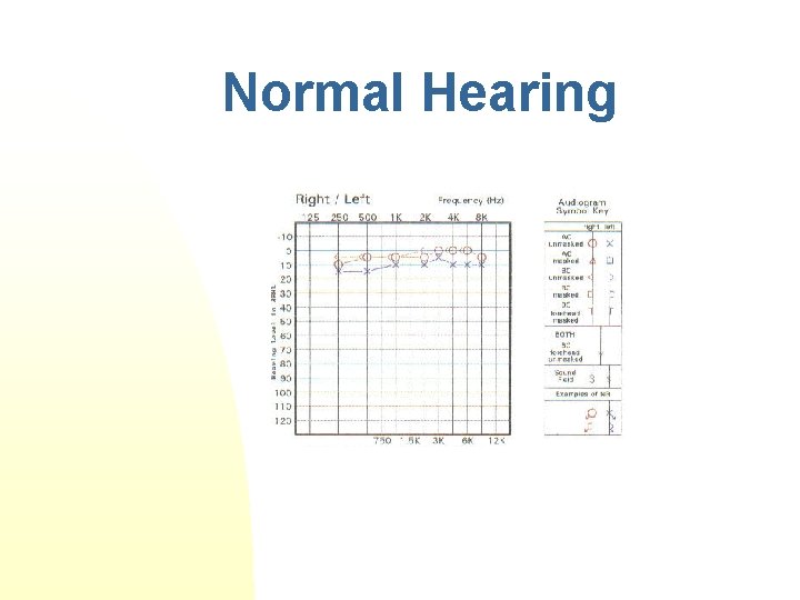 Introduction to Audiology n How to Read an