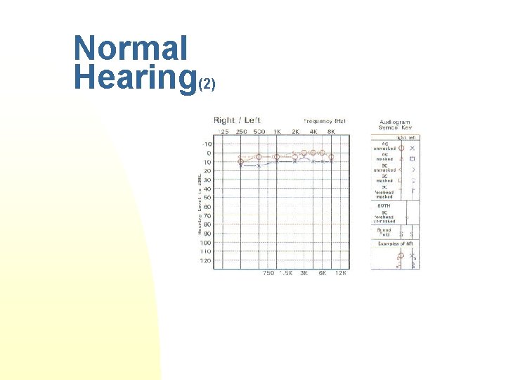 Introduction to Audiology n How to Read an