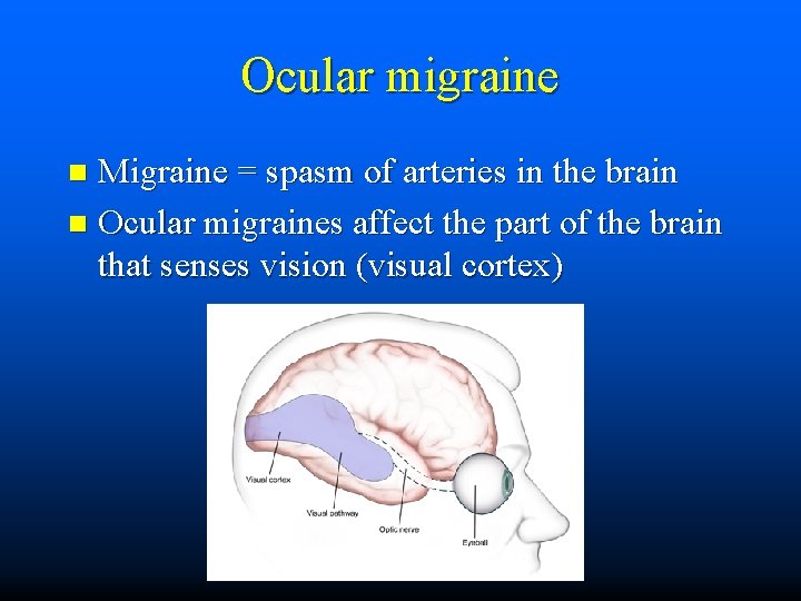 Ocular migraine Migraine = spasm of arteries in the brain n Ocular migraines affect