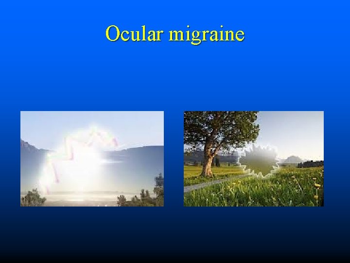 Ocular migraine 