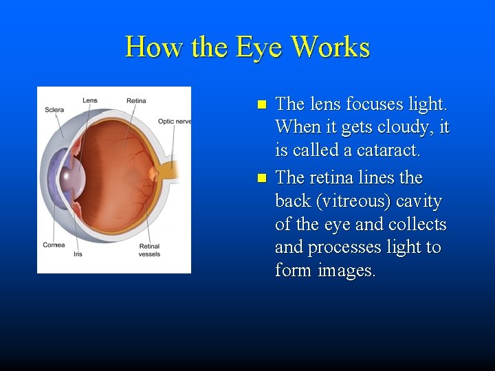 How the Eye Works n n The lens focuses light. When it gets cloudy,