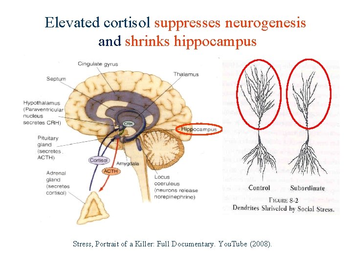 Elevated cortisol suppresses neurogenesis and shrinks hippocampus Stress, Portrait of a Killer: Full Documentary.