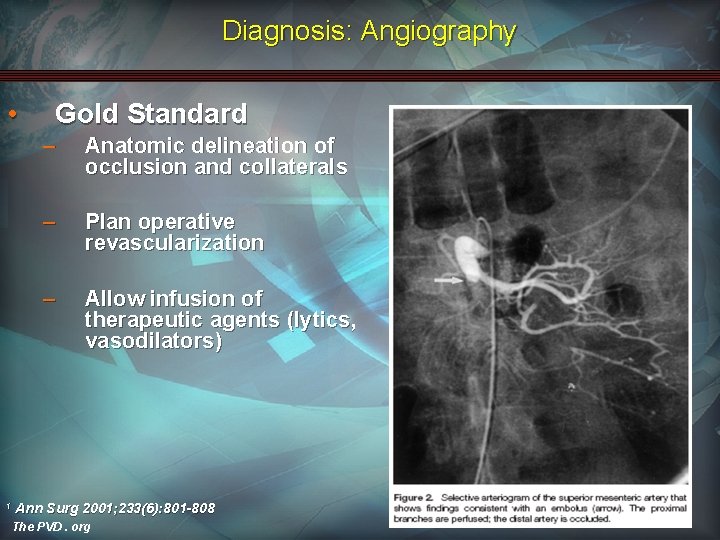 Diagnosis: Angiography • 1 Gold Standard – Anatomic delineation of occlusion and collaterals –