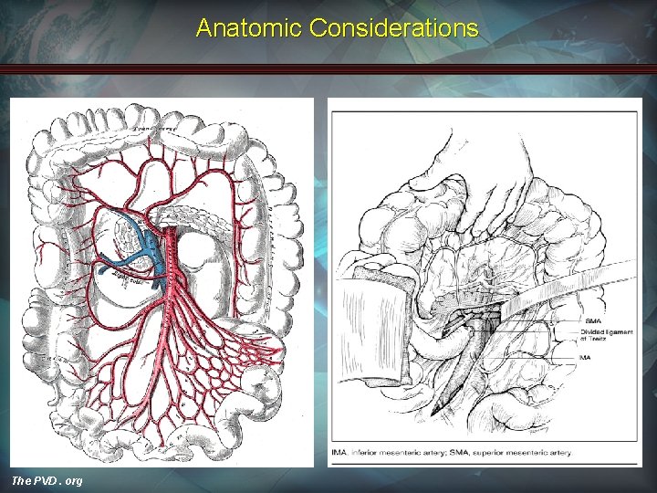 Anatomic Considerations The PVD. org 