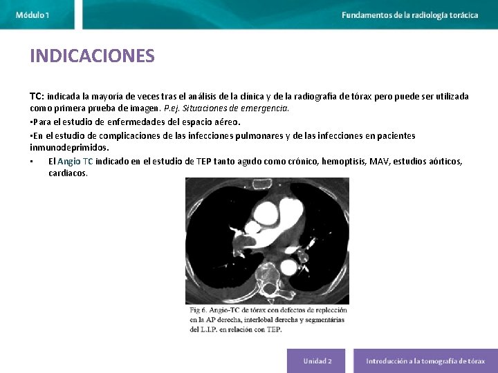 INDICACIONES TC: indicada la mayoría de veces tras el análisis de la clínica y INDICACIONES TC: indicada la mayoría de veces tras el análisis de la clínica y
