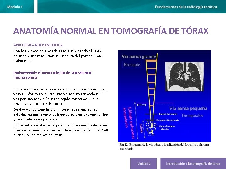 ANATOMÍA NORMAL EN TOMOGRAFÍA DE TÓRAX ANATOMÍA MICROSCÓPICA Con los nuevos equipos de TCMD ANATOMÍA NORMAL EN TOMOGRAFÍA DE TÓRAX ANATOMÍA MICROSCÓPICA Con los nuevos equipos de TCMD