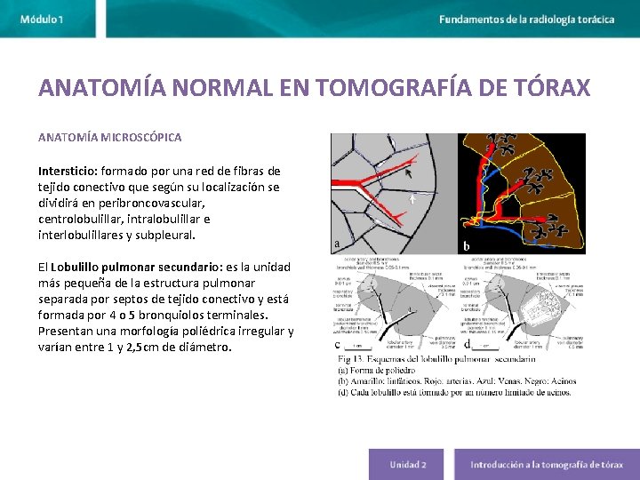 ANATOMÍA NORMAL EN TOMOGRAFÍA DE TÓRAX ANATOMÍA MICROSCÓPICA Intersticio: formado por una red de ANATOMÍA NORMAL EN TOMOGRAFÍA DE TÓRAX ANATOMÍA MICROSCÓPICA Intersticio: formado por una red de