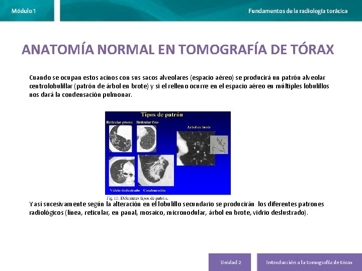 ANATOMÍA NORMAL EN TOMOGRAFÍA DE TÓRAX Cuando se ocupan estos acinos con sus sacos ANATOMÍA NORMAL EN TOMOGRAFÍA DE TÓRAX Cuando se ocupan estos acinos con sus sacos