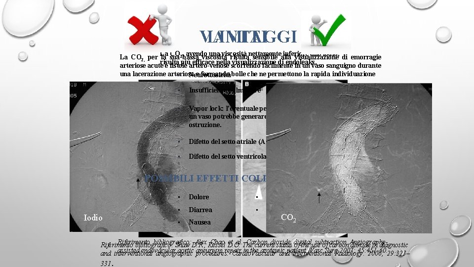 LIMITI VANTAGGI La CO , avendo una viscosità nettamente inferiore allo iodio, La CO