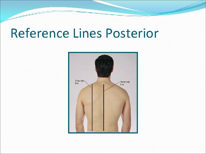 Reference Lines Posterior 