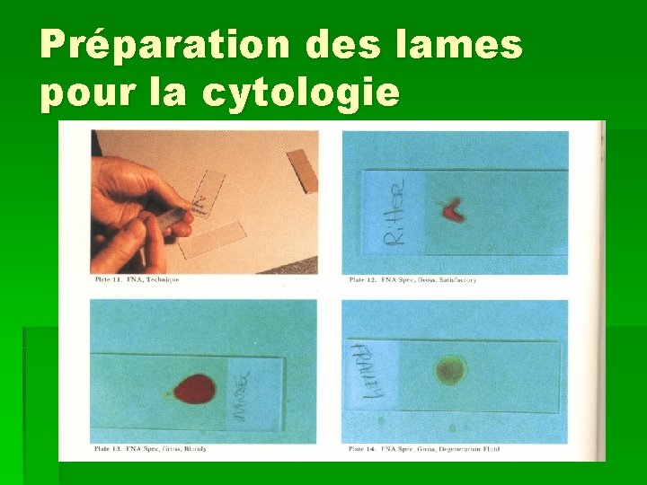 Préparation des lames pour la cytologie 