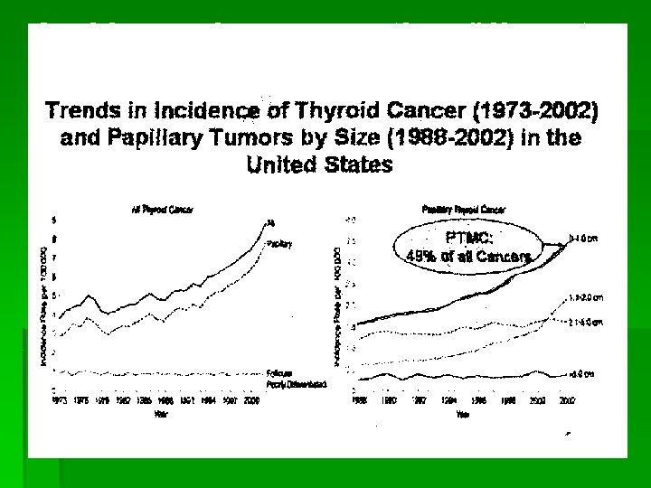 Incidence des cancer thyroïdien et des microcarcinomes papillaires au EUA 