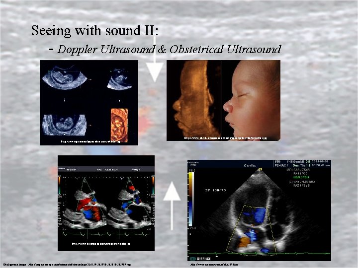 Seeing with sound II: - Doppler Ultrasound & Obstetrical Ultrasound http: //www. 3 d-4