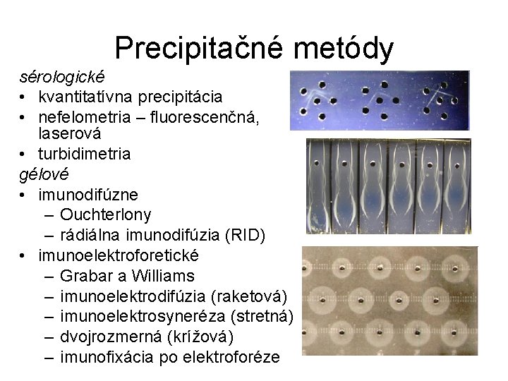 Precipitačné metódy sérologické • kvantitatívna precipitácia • nefelometria – fluorescenčná, laserová • turbidimetria gélové