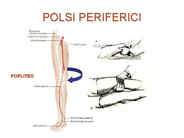 POLSI PERIFERICI POPLITEO 