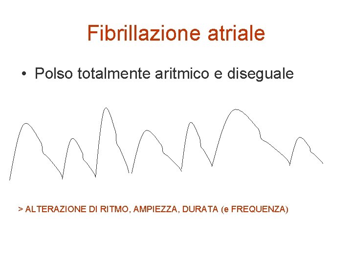 Fibrillazione atriale • Polso totalmente aritmico e diseguale > ALTERAZIONE DI RITMO, AMPIEZZA, DURATA