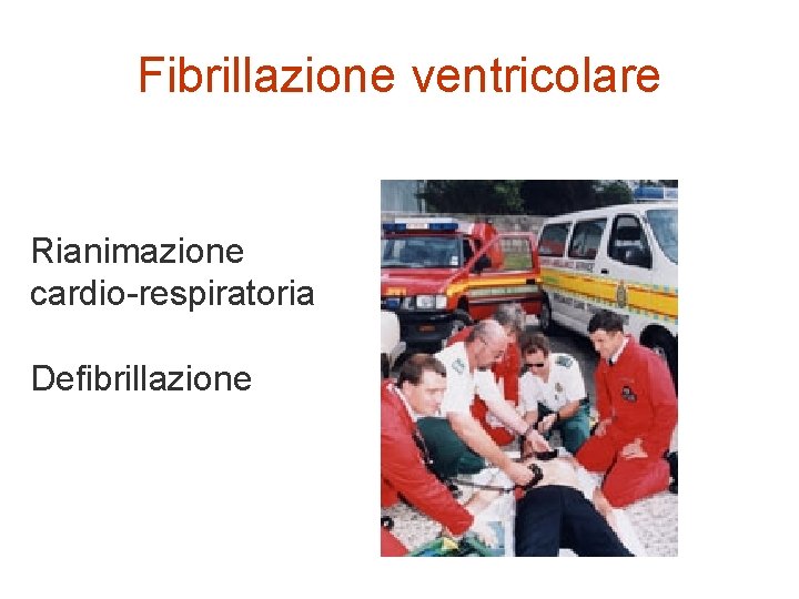 Fibrillazione ventricolare Rianimazione cardio-respiratoria Defibrillazione 
