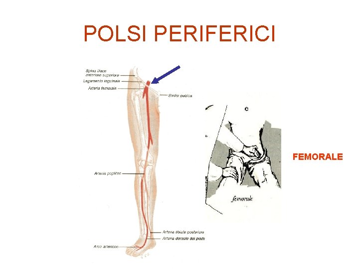 POLSI PERIFERICI FEMORALE 
