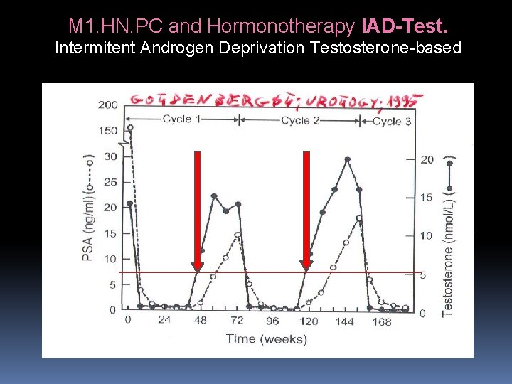 M 1. HN. PC and Hormonotherapy IAD-Test. Intermitent Androgen Deprivation Testosterone-based M 1. HN. PC and Hormonotherapy IAD-Test. Intermitent Androgen Deprivation Testosterone-based