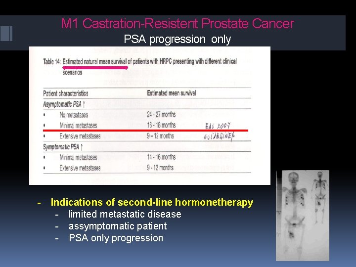 M 1 Castration-Resistent Prostate Cancer PSA progression only - Indications of second-line hormonetherapy - M 1 Castration-Resistent Prostate Cancer PSA progression only - Indications of second-line hormonetherapy -