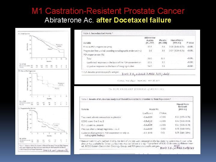 M 1 Castration-Resistent Prostate Cancer Abiraterone Ac. after Docetaxel failure M 1 Castration-Resistent Prostate Cancer Abiraterone Ac. after Docetaxel failure
