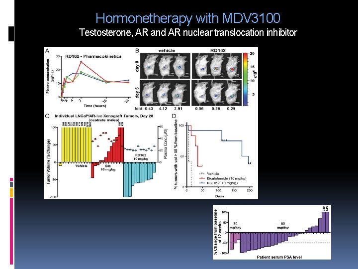 Hormonetherapy with MDV 3100 Testosterone, AR and AR nuclear translocation inhibitor Hormonetherapy with MDV 3100 Testosterone, AR and AR nuclear translocation inhibitor