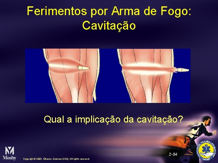 Ferimentos por Arma de Fogo: Cavitação Qual a implicação da cavitação? 2 -54 Copyright