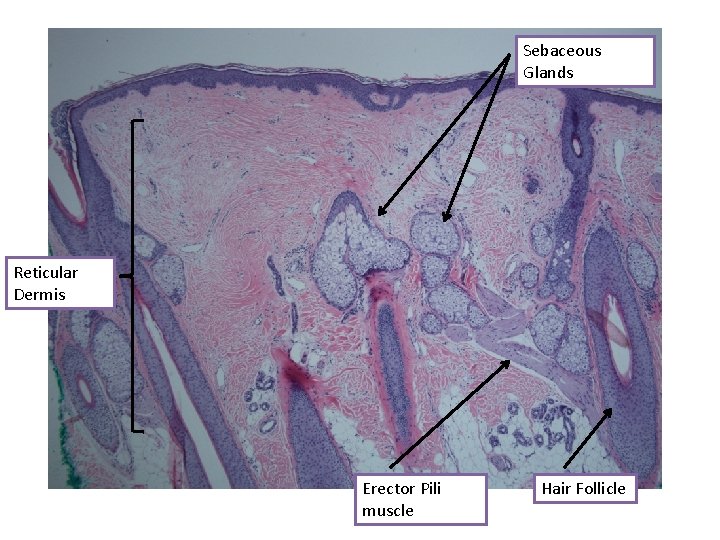 Sebaceous Glands Reticular Dermis Erector Pili muscle Hair Follicle 