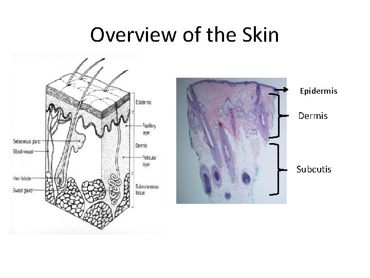 Overview of the Skin Epidermis Dermis Subcutis 