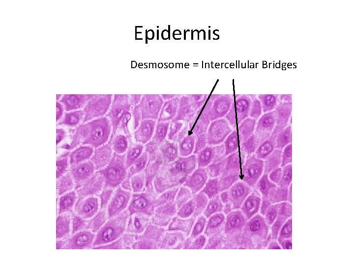 Epidermis Desmosome = Intercellular Bridges 