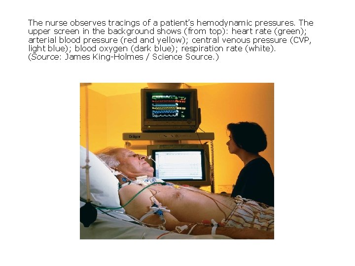 The nurse observes tracings of a patient’s hemodynamic pressures. The upper screen in the